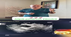 Atipik pankreas Tümörü