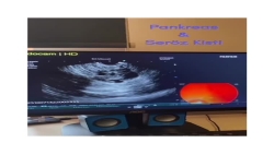 Pankreas & Seröz kisti