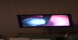 Uzun zamandan beri kilo problemlerine bağlı şeker hastalığı olan bir hastamıza zayıflama ve kan şekerini repüle etmek için balon uygulaması yaptık.